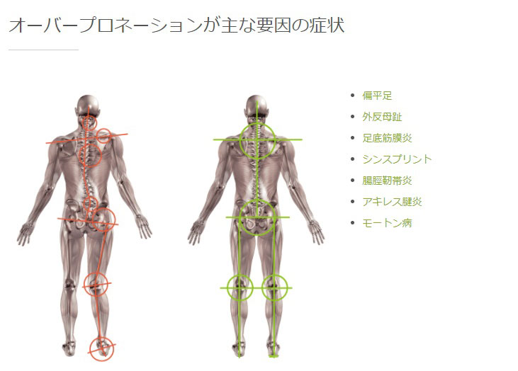 体を整えるインソール2
