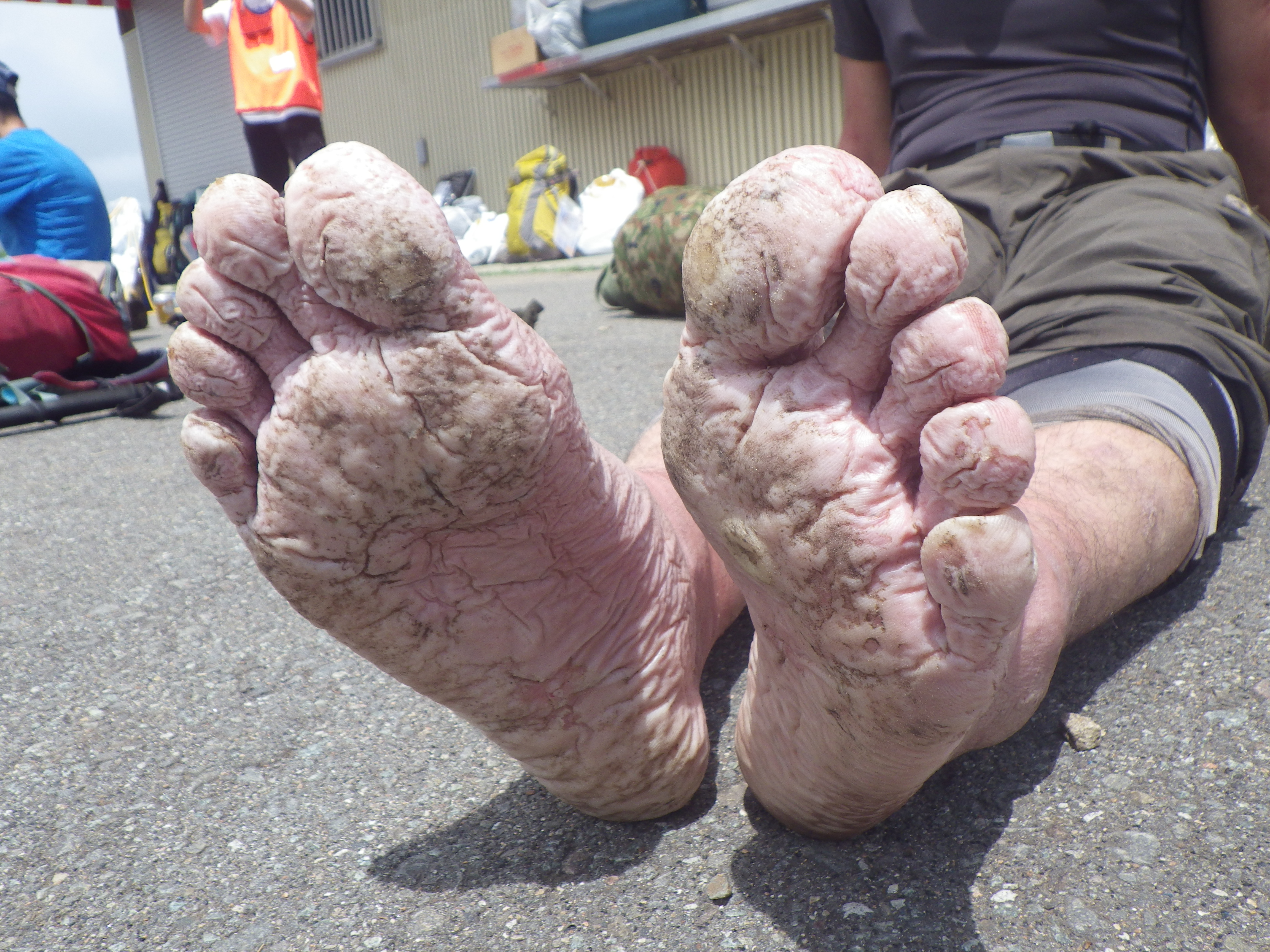 完全にふやけた足 3日間降られ続けた雨にヤラれてしまった